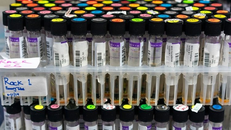 Tubos de cultivos de tuberculosis (Joao Silva/The New York Times)