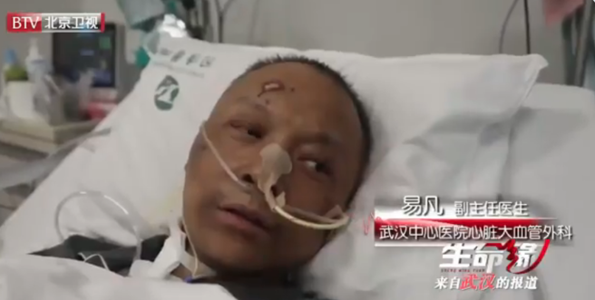 Yi Fan y Hu Weifeng, doctores chinos tratados con clororoquina para vencer al Covid 19 y cuya piel se ha vuelto de color negro