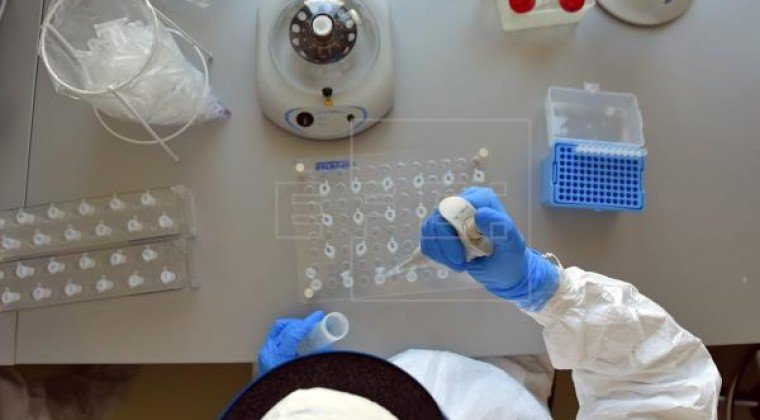 La agencia seguirá investigando el origen del virus. Foto: EFE