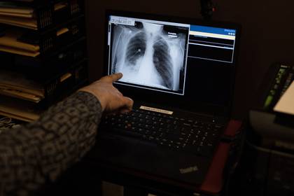 Además de afectar los pulmones, el COVID-19 daña los riñones, acelera el sistema inmunológico de manera catastrófica y puede causar coágulos que impiden la circulación de la sangre a los pulmones, el corazón o el cerebro. (REUTERS/Megan Jelinger)